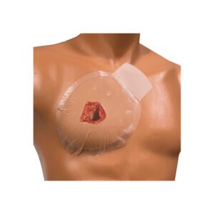 Chest Seal at MS Medicals